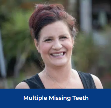 A cheerful woman with a wide smile, revealing multiple missing teeth, highlighting her positive attitude.