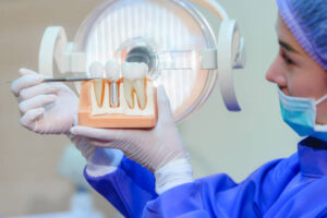 dental im[plants